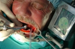 Computergestützte dentale Implantologie